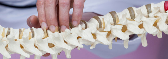 Chiropractic Snohomish WA Facet Syndrome Chiropractic Snohomish WA Facet Syndrome